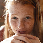 Deeply Freckled Redhead Stares Into Camera